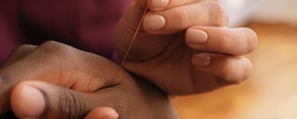 A person receiving acupuncture.
