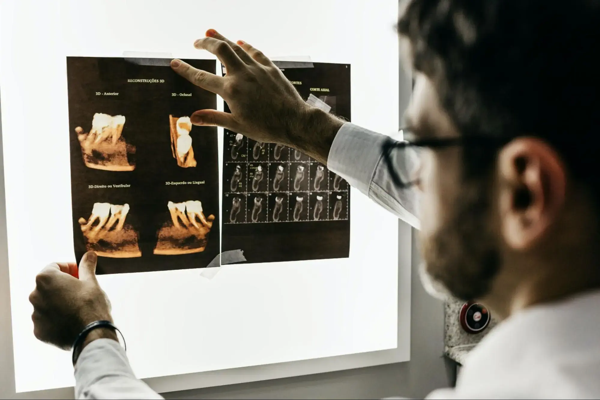 A doctor who is looking at x-rays of his patient.